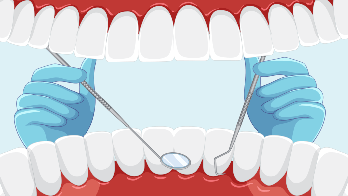 Initial Phase Therapy Periodontal